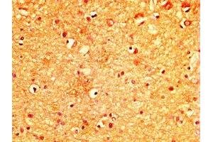 IHC image of ABIN7174953 diluted at 1:300 and staining in paraffin-embedded human brain tissue performed on a Leica BondTM system. (MYO5A 抗体  (AA 1087-1220))