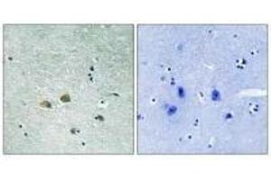 Immunohistochemistry analysis of paraffin-embedded human brain tissue using PAK1 (Ab-204) antibody. (PAK1 抗体  (Ser204))