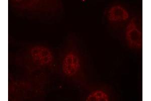Immunofluorescence staining of methanol-fixed Hela cells using Myc(Phospho-Ser62) Antibody. (c-MYC 抗体  (pSer62))