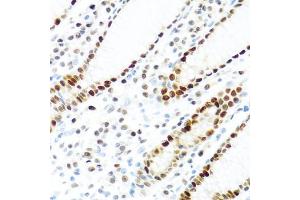 Immunohistochemistry of paraffin-embedded human stomach using KHDRBS2 antibody (ABIN5975782) at dilution of 1/100 (40x lens). (KHDRBS2 抗体)