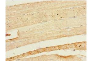 Immunohistochemistry of paraffin-embedded human skeletal muscle tissue using ABIN7152072 at dilution of 1:100 (EHF 抗体  (AA 1-210))