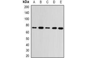 Western blot analysis of GMPS expression in MCF7 (A), SKOV3 (B), mouse kidney (C), mouse brain (D), rat heart (E) whole cell lysates. (GMP Synthase 抗体)