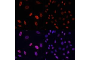 Immunofluorescence analysis of NIH/3T3 cells using Acetyl-Histone H3-K9 antibody (ABIN7267675) at dilution of 1:100 (40x lens).