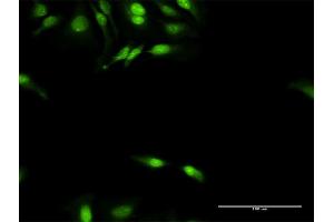 Immunofluorescence of purified MaxPab antibody to DNAJB4 on HeLa cell. (DNAJB4 抗体  (AA 1-337))