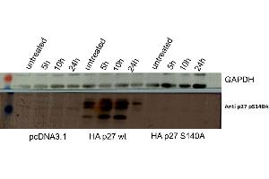 Western Blotting (WB) image for anti-Cyclin-Dependent Kinase Inhibitor 1B (p27, Kip1) (CDKN1B) (pSer140) antibody (ABIN5596806)