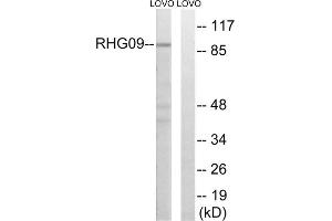 Western blot analysis of extracts from LOVO cells, using RHG9 antibody. (ARHGAP9 抗体  (Internal Region))