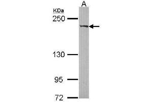 WB Image Sample (30 ug of whole cell lysate) A: A431 , 5% SDS PAGE antibody diluted at 1:1000 (RECQL2 抗体  (Center))