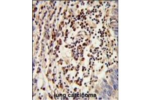 Immunohistochemistry (Paraffin-embedded Sections) (IHC (p)) image for anti-Mitochondrial Amidoxime Reducing Component 2 (MARC2) (AA 270-300), (C-Term) antibody (ABIN652632)