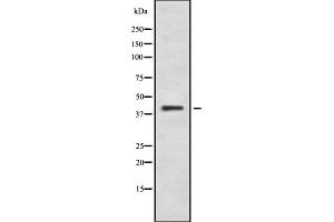 Western blot analysis of PKR2 using K562 whole cell lysates (Prokineticin Receptor 2 抗体  (C-Term))