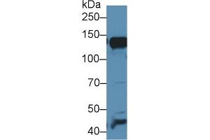Western blot analysis of Mouse Liver lysate, using Mouse AAP Antibody (1 µg/ml) and HRP-conjugated Goat Anti-Rabbit antibody ( (ALT 抗体  (AA 720-961))