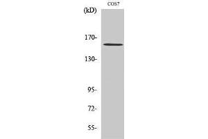 Western Blotting (WB) image for anti-rho-Associated, Coiled-Coil Containing Protein Kinase 1 (ROCK1) (Internal Region) antibody (ABIN3180302) (ROCK1 抗体  (Internal Region))