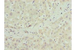 Immunohistochemistry of paraffin-embedded human liver tissue using ABIN7149063 at dilution of 1:100 (CRISPLD1 抗体  (AA 24-300))
