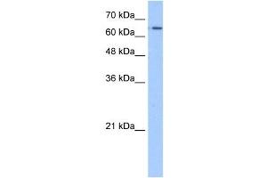 SLC22A11 antibody used at 1. (SLC22A11 抗体)