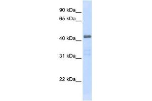 SLC29A2 antibody used at 1 ug/ml to detect target protein. (SLC29A2 抗体)