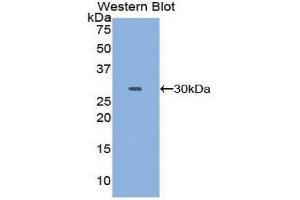 Western Blotting (WB) image for anti-DNA Topoisomerase II (TOP2) (AA 923-1148) antibody (ABIN1860829) (TOP2 抗体  (AA 923-1148))