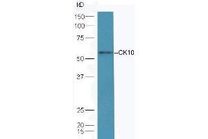 Mouse skin lysate probed  at 1:5000 90min in 37˚C. (Keratin 10 抗体  (AA 151-250))