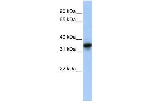 MUC3B antibody used at 1 ug/ml to detect target protein. (MUC3B 抗体  (N-Term))