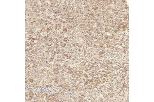 Immunohistochemical analysis of paraffin-embedded Human-liver tissue. (TGFBR1 抗体  (pSer165))