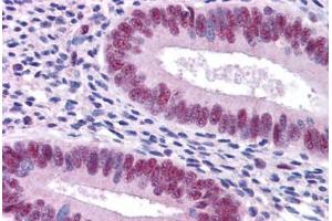 Immunohistochemistry (Formalin-fixed Paraffin-embedded Sections) (IHC (fp)) image for anti-Signal Transducer and Activator of Transcription 3 (Acute-Phase Response Factor) (STAT3) (AA 683-732) antibody (ABIN604780)
