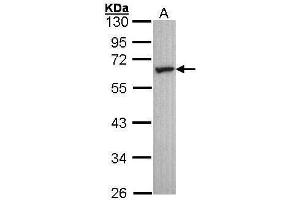 WB Image Sample (30 ug of whole cell lysate) A: A431 , 10% SDS PAGE antibody diluted at 1:1000 (HTR2C 抗体  (C-Term))
