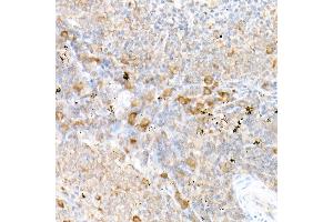Immunohistochemistry of paraffin-embedded mouse testis using CD81 Rabbit pAb (ABIN6134776, ABIN6138231, ABIN6138232 and ABIN6220897) at dilution of 1:50 (40x lens).