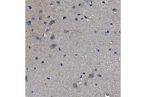 IHC analysis of ADRA1A using anti-ADRA1A antibody (ABIN3043732). (alpha 1 Adrenergic Receptor 抗体  (C-Term))