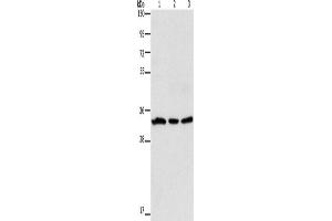 Western Blotting (WB) image for anti-Glycoprotein A33 (Transmembrane) (GPA33) antibody (ABIN2428183) (GPA33 抗体)