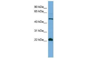 HEMGN antibody used at 0. (HEMGN 抗体  (N-Term))