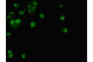 Immunofluorescent analysis of MCF-7 cells using ABIN7171562 at dilution of 1:100 and Alexa Fluor 488-congugated AffiniPure Goat Anti-Rabbit IgG(H+L) (TAF1C 抗体  (AA 70-320))