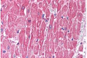 Human Heart (formalin-fixed, paraffin-embedded) stained with CLIC5 antibody ABIN214746 at 2. (CLIC5 抗体  (C-Term))