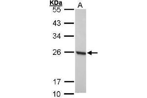 WB Image Sample (30 ug of whole cell lysate) A: 293T 12% SDS PAGE antibody diluted at 1:1000 (Peroxiredoxin 1 抗体)