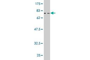 Western Blot detection against Immunogen (71. (Casein Kinase 1 gamma 2 抗体  (AA 1-415))