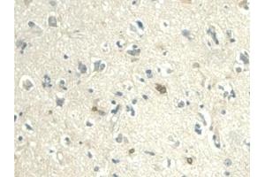 Immunohistochemistry (IHC) image for anti-Nicotinamide phosphoribosyltransferase (NAMPT) (AA 1-491) antibody (ABIN7432295)