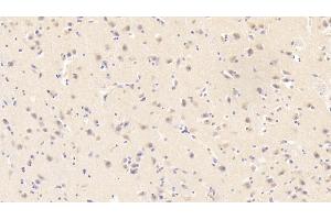 Detection of RETN in Human Cerebrum Tissue using Monoclonal Antibody to Resistin (RETN) (Resistin 抗体  (AA 17-108))