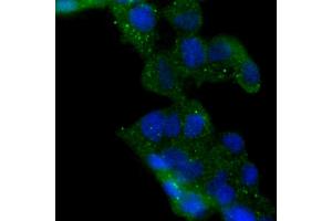 293 cells were stained with HDAC6 (6B4) Monoclonal Antibody  at 1:200 dilution, incubated overnight at 4C, followed by secondary antibody incubation, DAPI staining of the nuclei and detection.