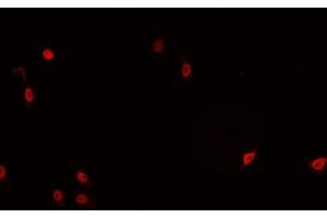ABIN6266766 staining HeLa cells by IF/ICC. (TNFAIP8 抗体  (Internal Region))