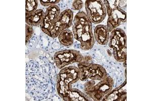 Immunohistochemical staining of human kidney with DPEP1 polyclonal antibody  shows strong cytoplasmic and membranous positivity in cells in tubules. (DPEP1 抗体)