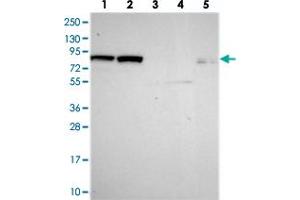Western blot analysis of Lane 1: RT-4, Lane 2: U-251 MG, Lane 3: Human Plasma, Lane 4: Liver, Lane 5: Tonsil with DHX40 polyclonal antibody  at 1:250-1:500 dilution. (DEAH (Asp-Glu-Ala-His) Box Polypeptide 40 (DHX40) 抗体)