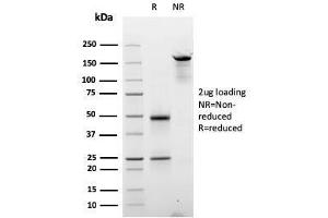 SDS-PAGE Analysis Purified Cyclin D2 Mouse Monoclonal Antibody (CCND2/2620). (Cyclin D2 抗体)