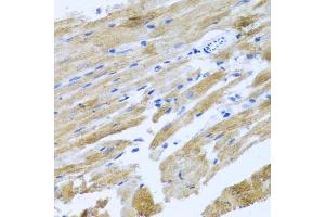 Immunohistochemistry of paraffin-embedded rat heart using MOK antibody (ABIN3022550, ABIN3022551, ABIN3022552 and ABIN6218895) at dilution of 1:100 (40x lens). (MOK 抗体  (AA 1-230))