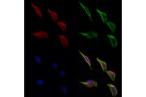ABIN6266307 and ABIN6277426 staining Hela cells by IF/ICC.