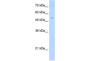 WB Suggested Anti-ZNF239 Antibody Titration:  0. (ZNF239 抗体  (Middle Region))