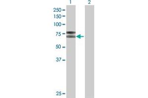 Western Blotting (WB) image for IL2RB 293T Cell Transient Overexpression Lysate(Denatured) (ABIN1332328)
