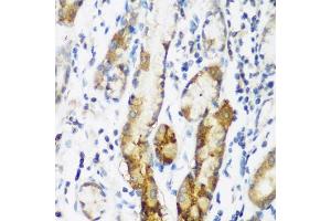 Immunohistochemistry (IHC) image for anti-N-Acetyltransferase 15 (NAT15) (AA 1-242) antibody (ABIN6144330)