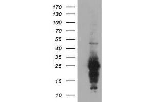 Western Blotting (WB) image for anti-Regulator of G-Protein Signaling 16 (RGS16) antibody (ABIN1500690) (RGS16 抗体)
