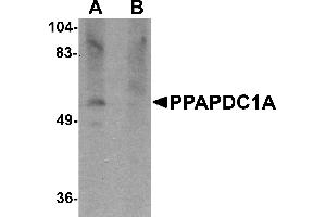 Western blot analysis of PPAPDC1A in human brain tissue lysate with PPAPDC1A antibody at 1 µg/mL in (A) the absence and (B) the presence of blocking peptide. (PPAPDC1A 抗体  (C-Term))