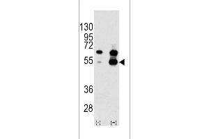 Western blot analysis of VEGF1 Antibody (N-term) polyclonal antibody (ABIN390254 and ABIN2840716) (arrow). (VEGF1 抗体  (N-Term))
