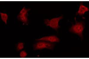 ABIN6267693 staining 293 by IF/ICC. (GRLF1 抗体  (pTyr1105))