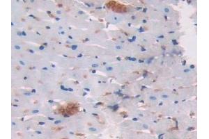 Detection of LCNL1 in Rat Heart Tissue using Polyclonal Antibody to Lipocalin Like Protein 1 (LCNL1) (LCNL1 抗体)
