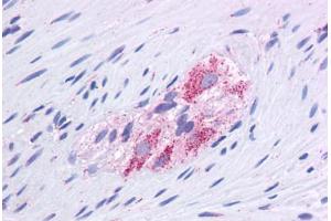 Human Colon, Myenteric Plexus: Formalin-Fixed, Paraffin-Embedded (FFPE) (GLUD1 抗体  (AA 182-231))